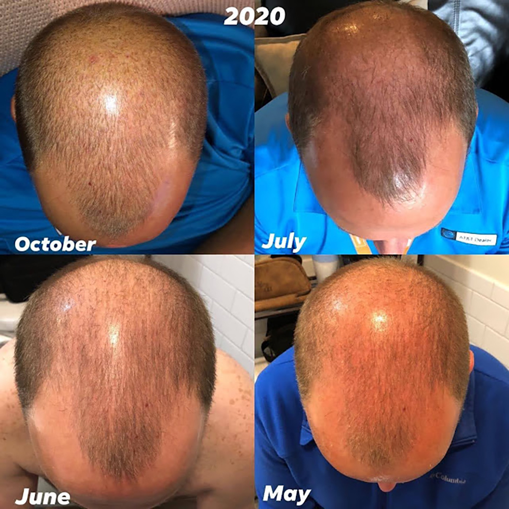 Modere Liquid Collagen results